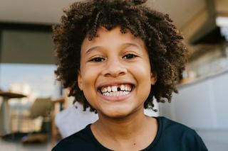 Missing Teeth