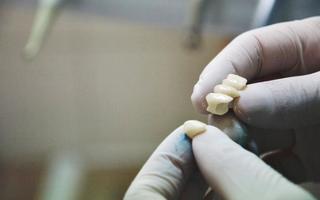Dentist holding a completed dental bridge and crown
