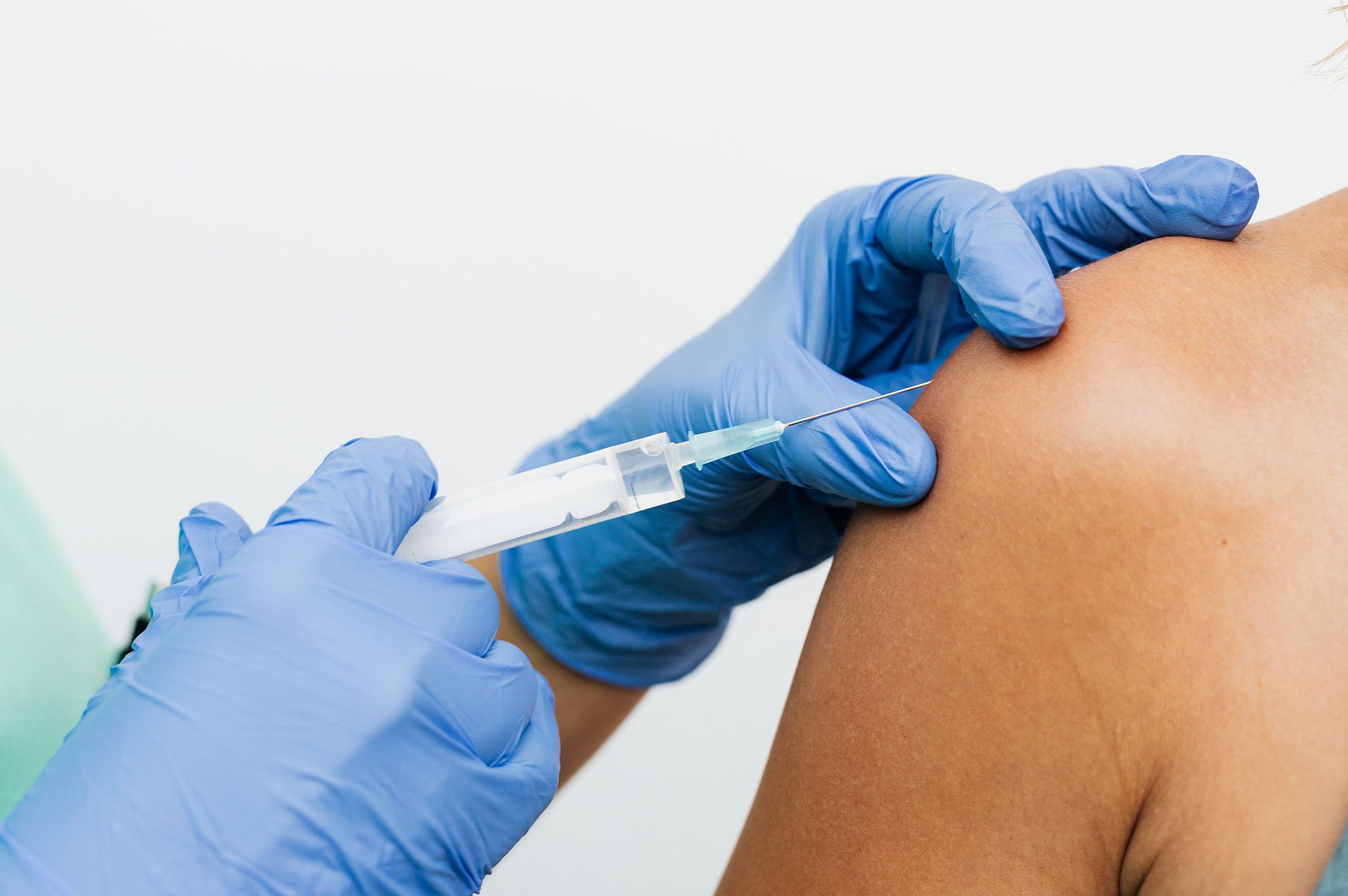 HPV (Human Papillomavirus)