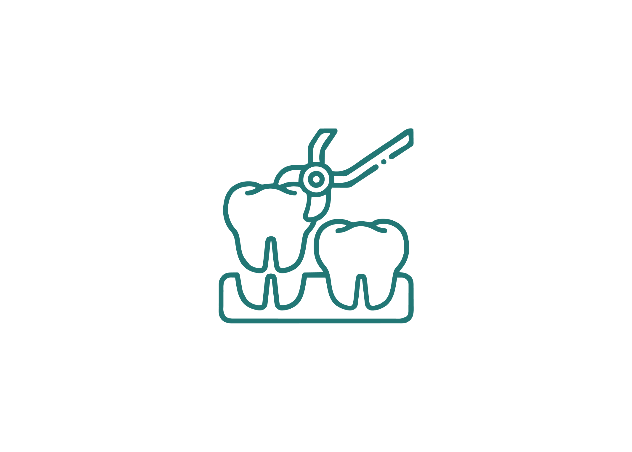 dental extraction illustration
