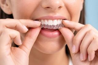Tooth alignment