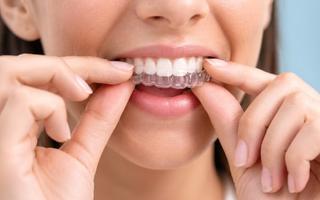 Take-Home Teeth Whitening