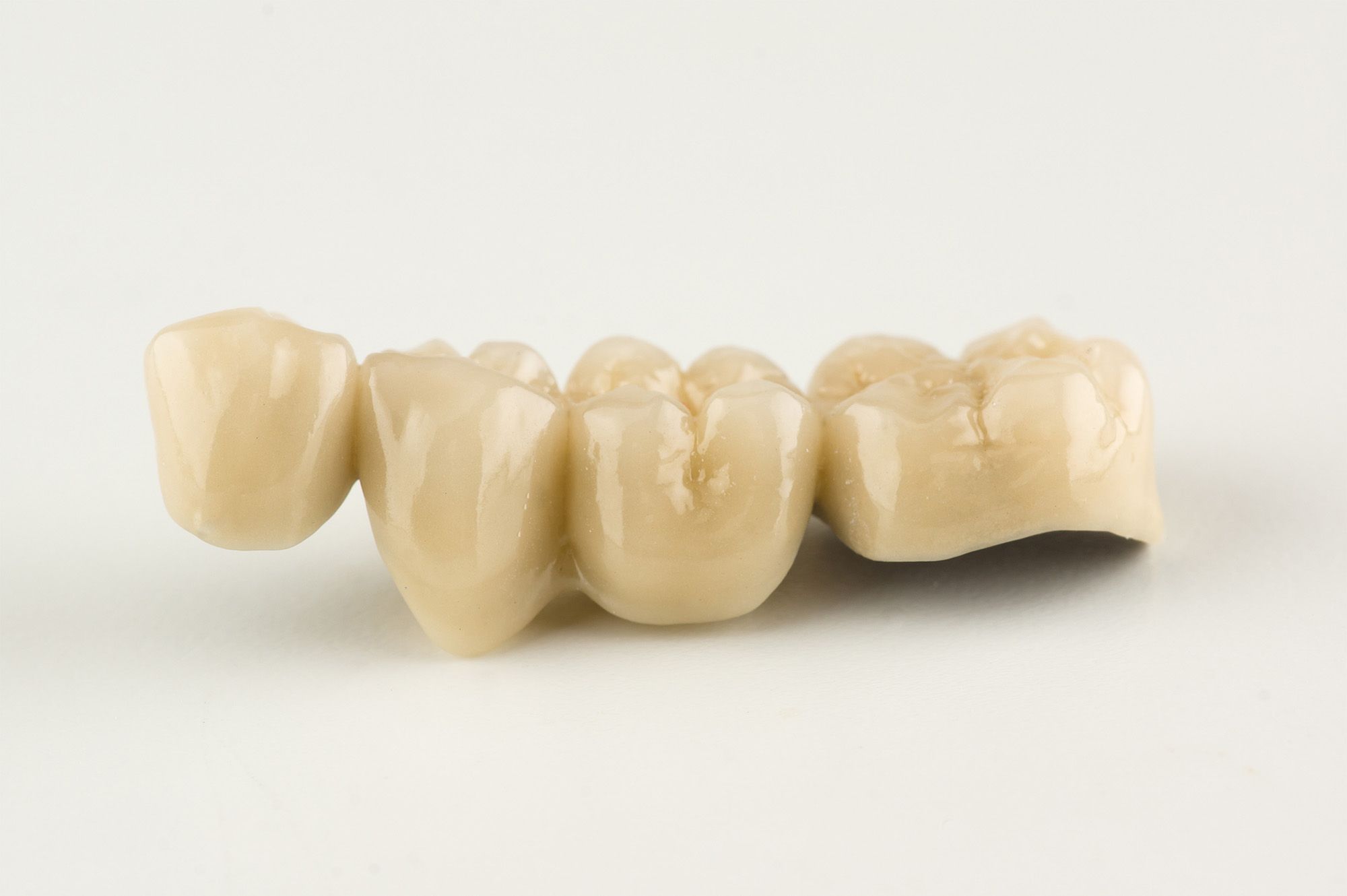 All-Porcelain Crowns
