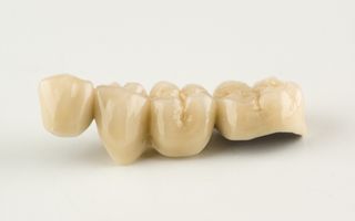 Image of a dental bridge with a white background.