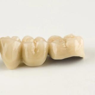 Porcelain / all-ceramic crowns