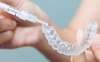 take-home teeth whitening example