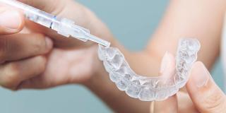 Take-home Whitening