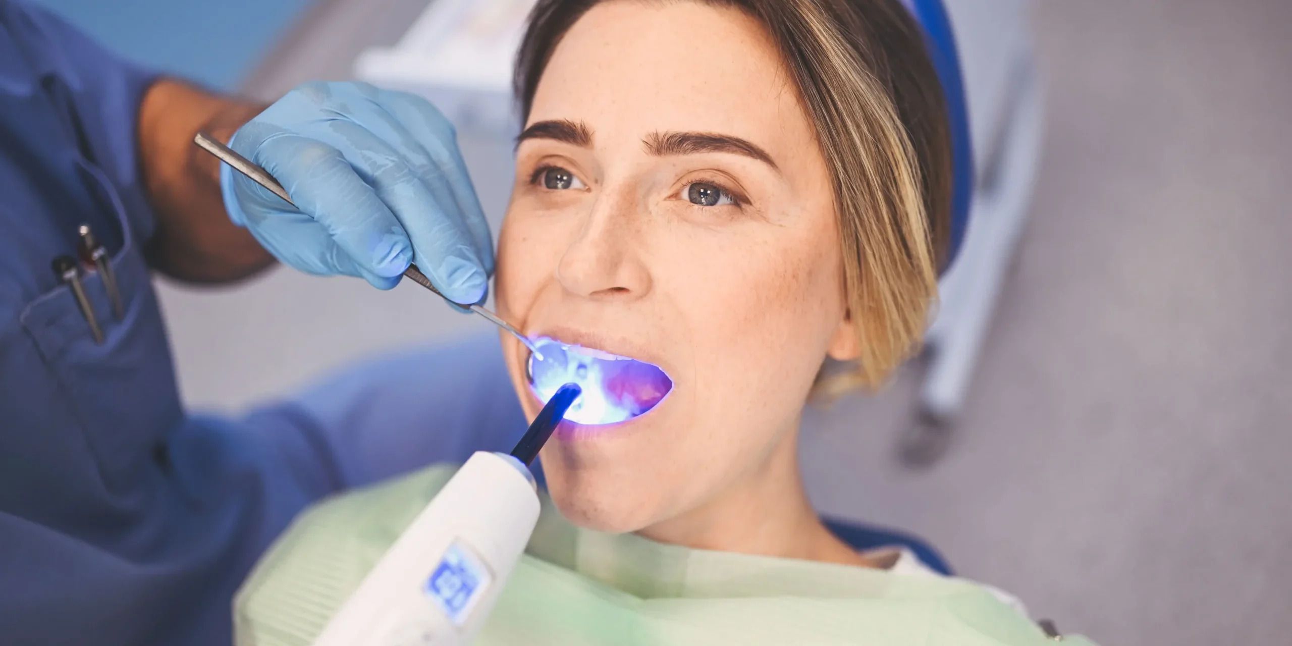 How Do I Know If I Need a Filling?
