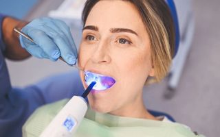 How Do I Know If I Need a Filling?