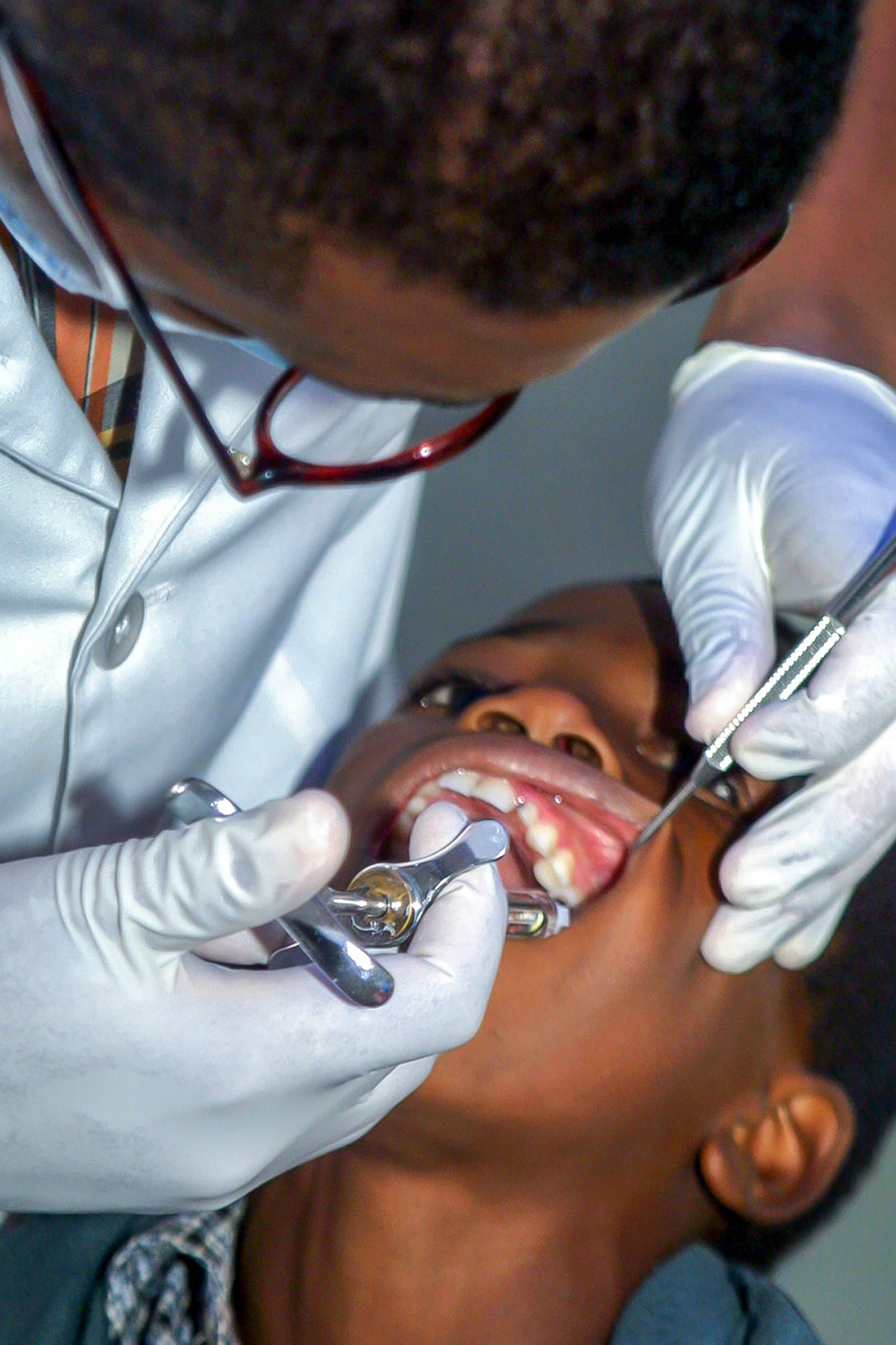 Objects wedged between your teeth.