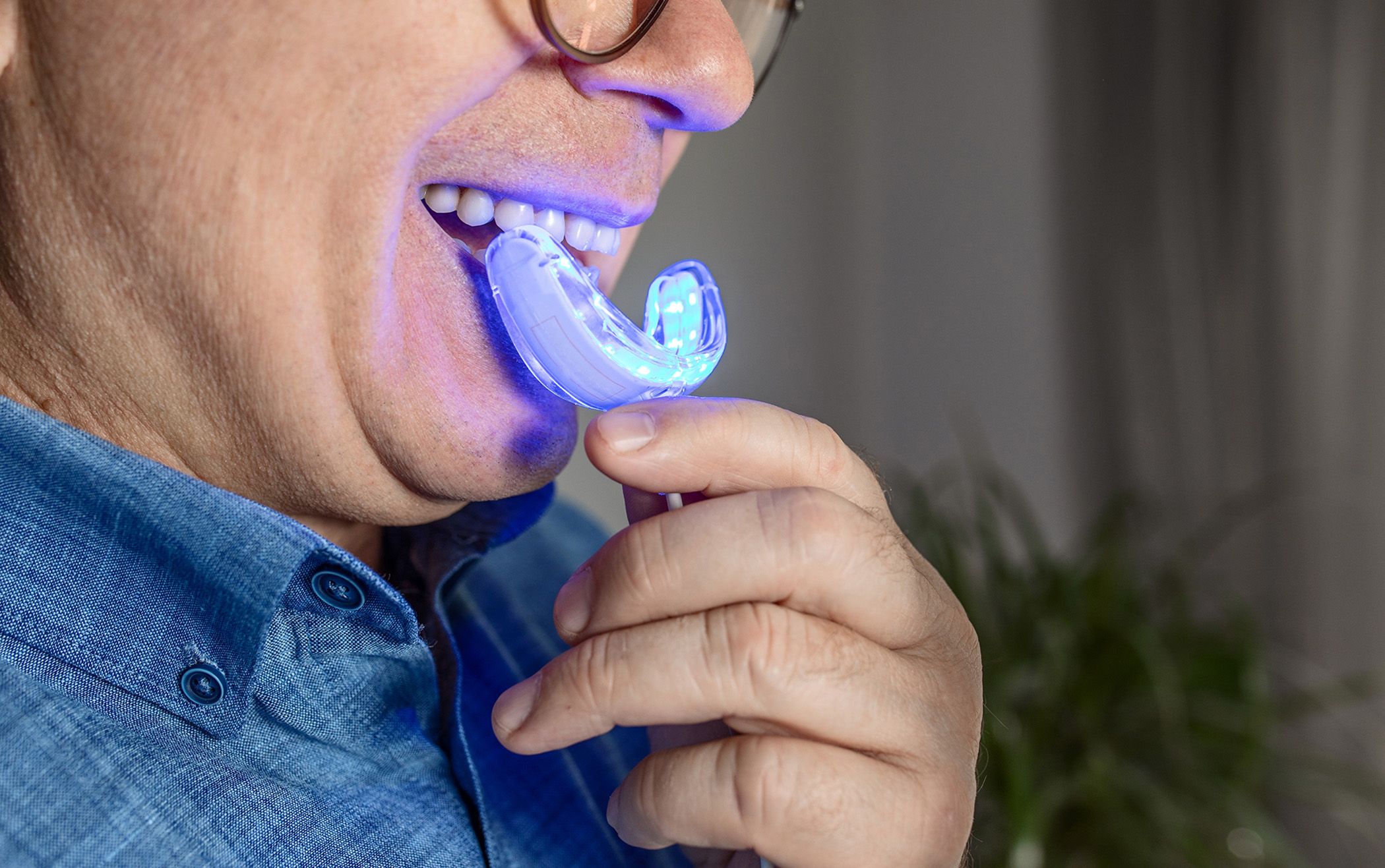 At-home whitening kits