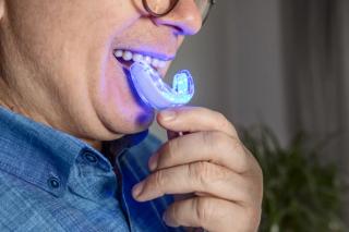 At-home whitening kits