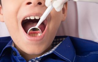 The benefits of tooth-coloured fillings include: