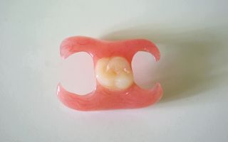 An image of a single immediate denture that replaces one tooth and ready to go.