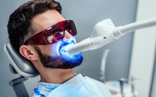 Male patient undergoing a in-chair teeth whitening procedure