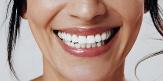 Fluoride Treatments for Teeth - Hero