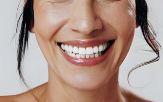 Fluoride Treatments for Teeth