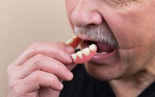 Immediate dentures