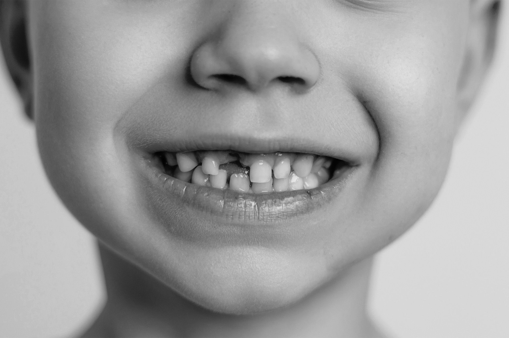 We Welcome Kids to Our Dental Family 3