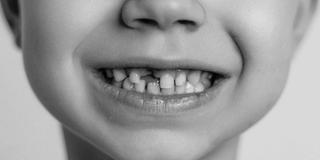We Welcome Kids to Our Dental Family 3
