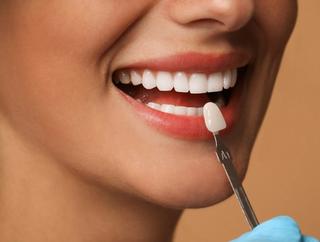 Why Choose Wyndham Dental Solutions For Your Veneers?