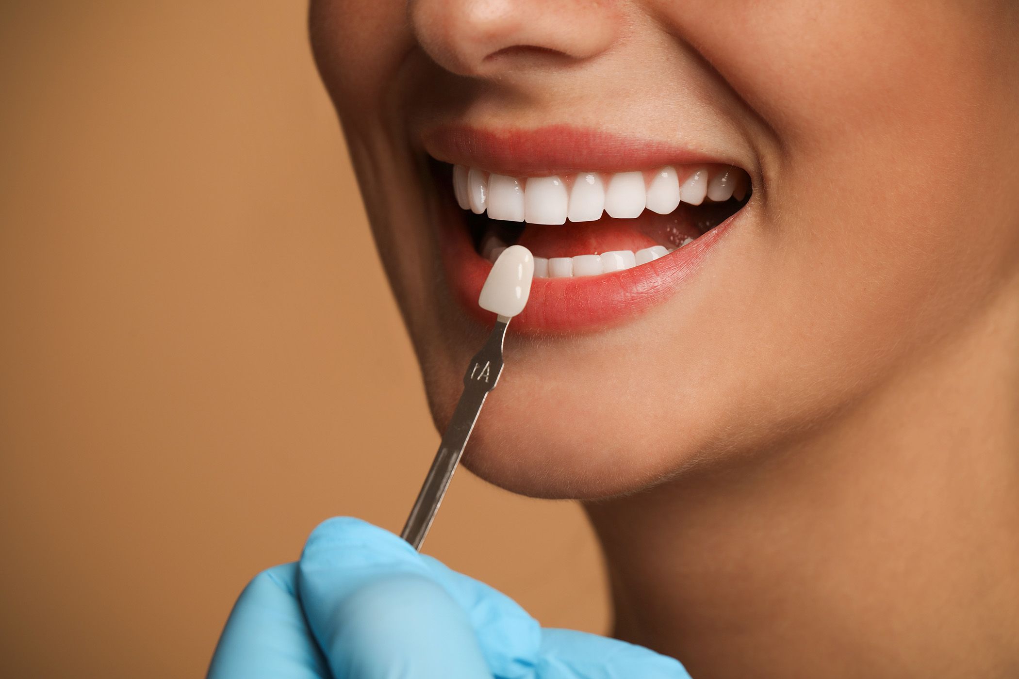 Smile with Dental Veneers from Ranford Road Dental Centre.
