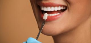 Smile with Dental Veneers from Ranford Road Dental Centre.