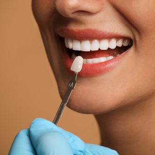 Veneers at Ranford Road Dental Centre.