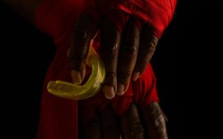 Boil-and-Bite mouthguard