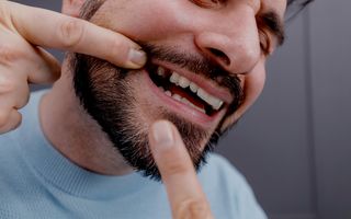 Missing Teeth Solutions