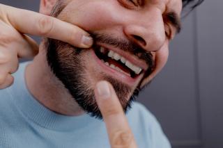 Dentures for Missing Teeth: