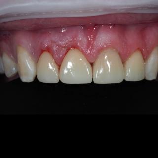 Jasper After