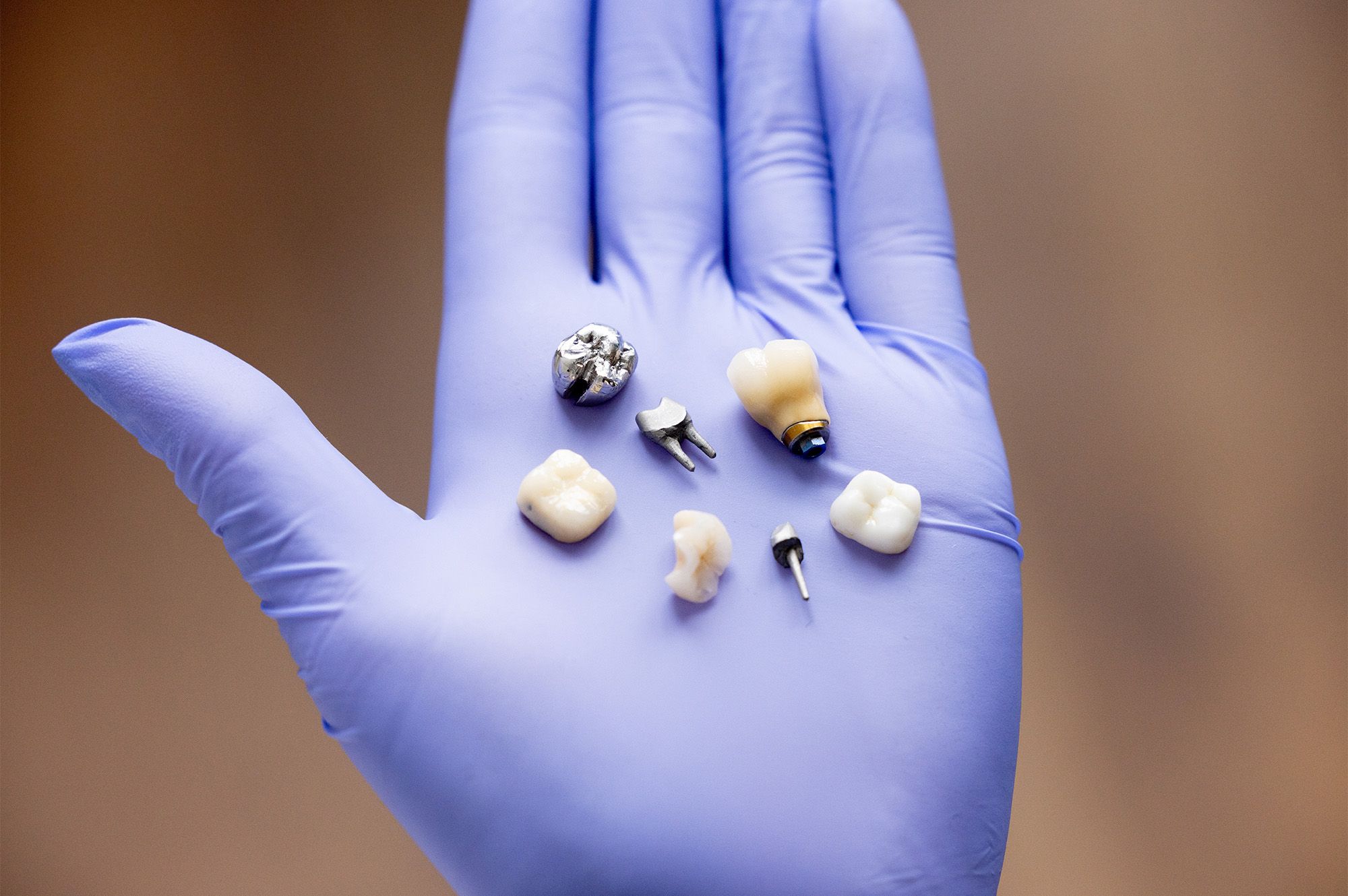 Dental Crowns - Hero