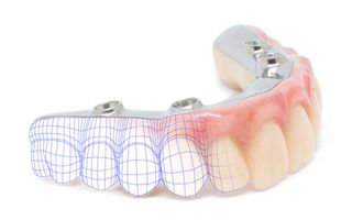 Take the step toward a stable, confident, and worry-free smile today