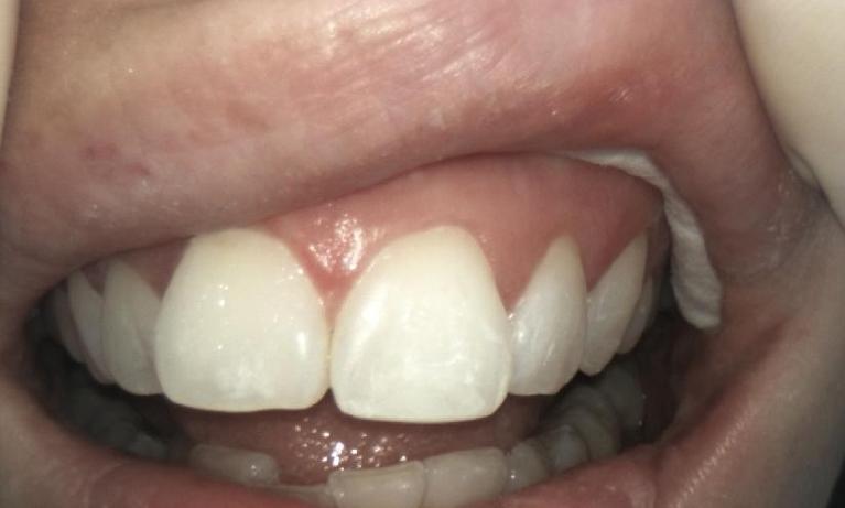 General Dentistry - After