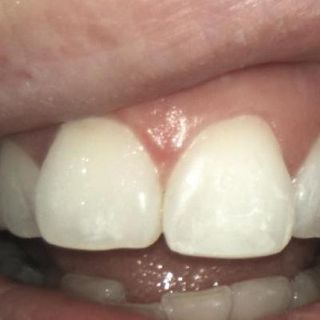 General Dentistry - After