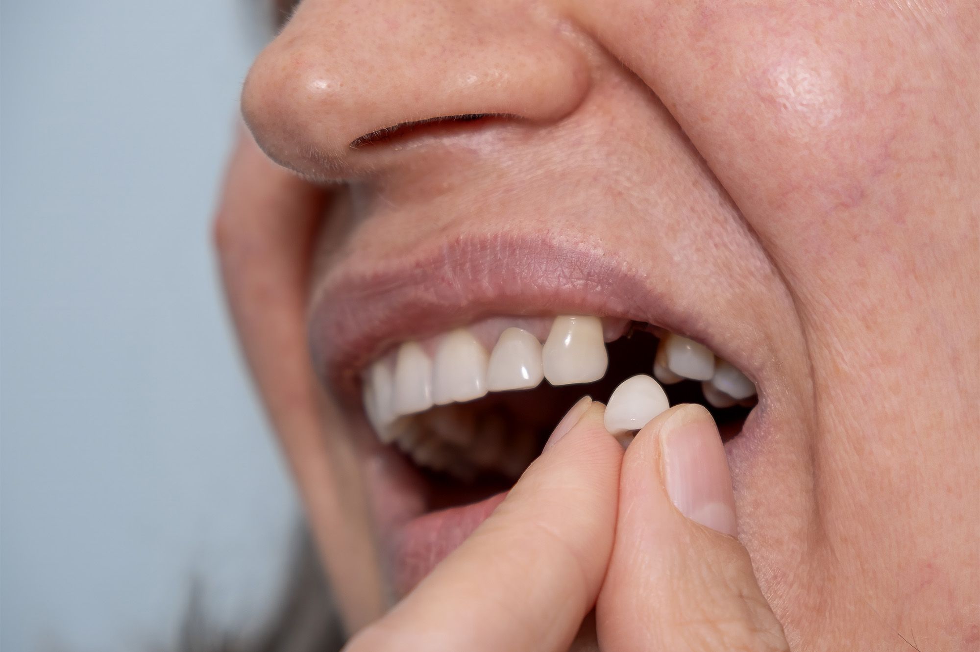 Sick of your dentures?