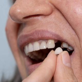 Book Your Implant Consultation