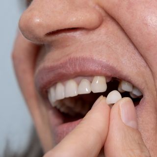 Sick of your dentures?