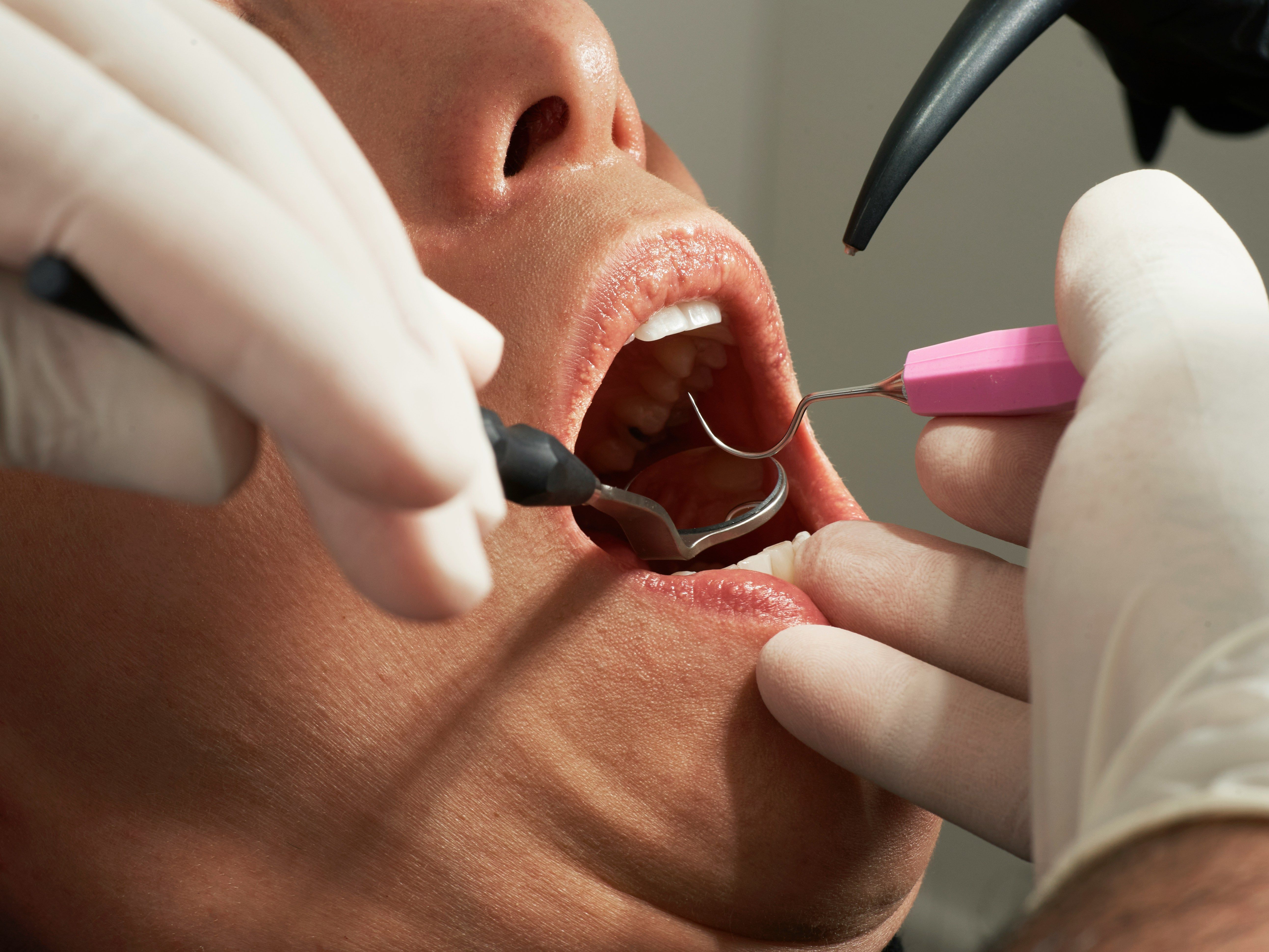 What is an Endodontist?