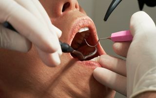 What is an Endodontist?