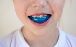 Store-Bought Mouthguards