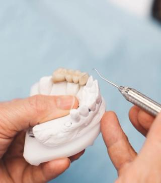 Image of a dental bridge on a plastic jaw.