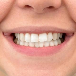 What Results Can I Expect?