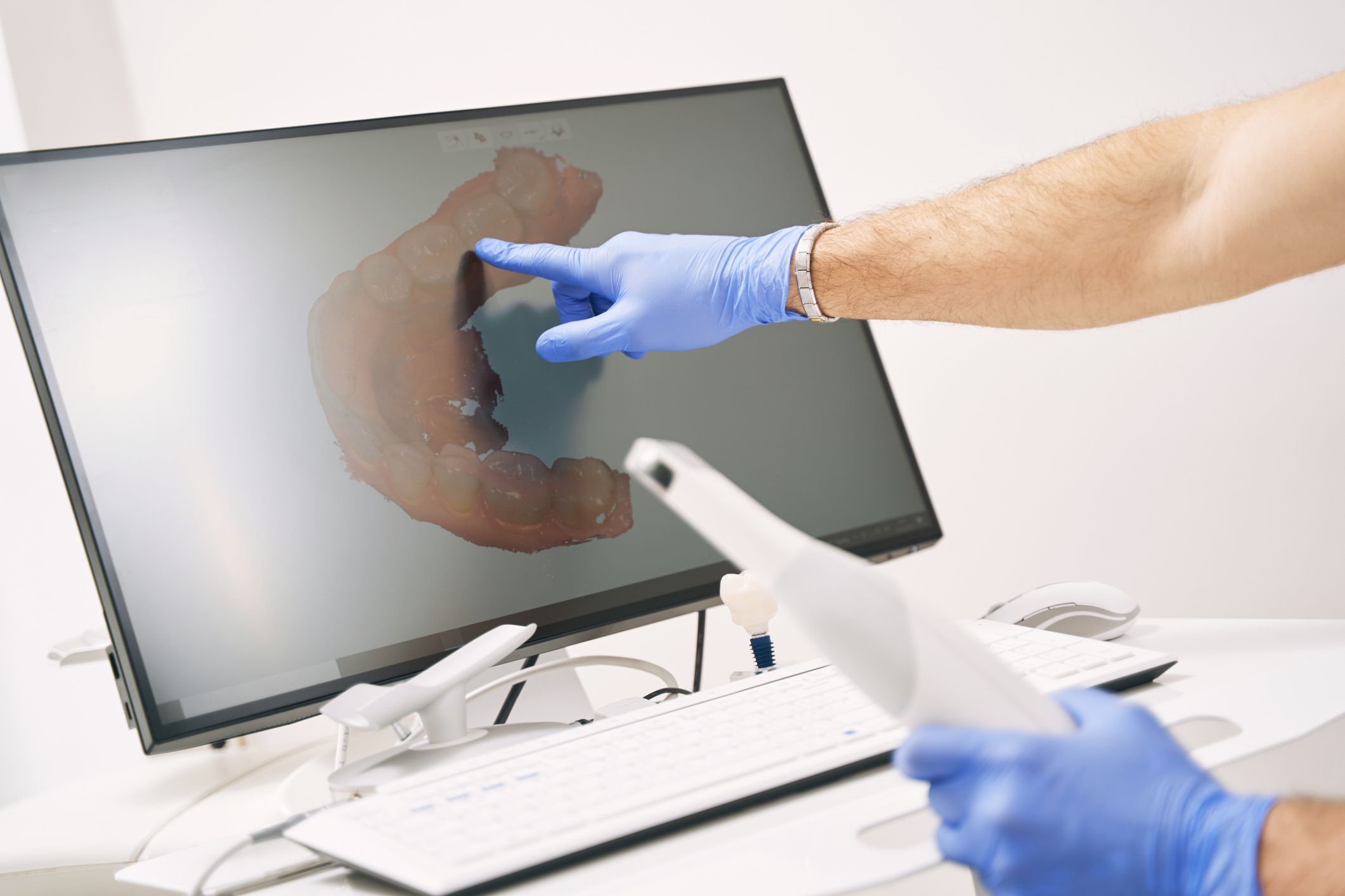 3D scanning dental technology