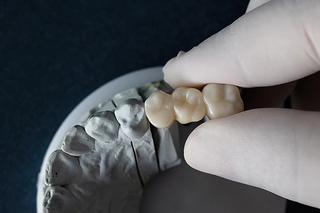what is a dental bridge