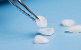 Dentist inspecting veneers before application