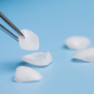 What Are Porcelain Veneers?