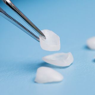 Image of veneers being picked up by dental tweezers.
