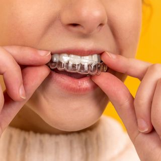 How does Invisalign® work?